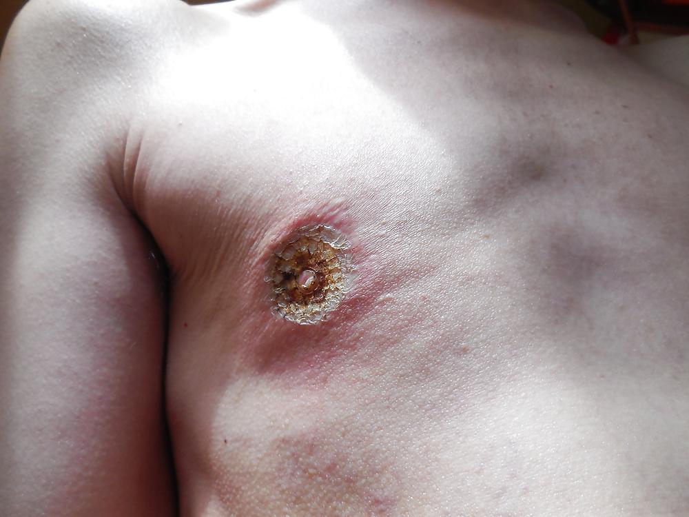 25P Tits in pain