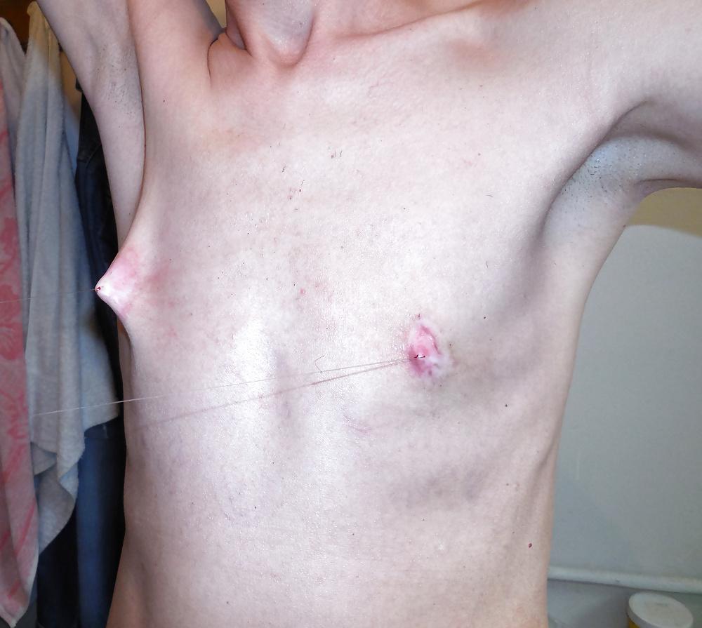 25P Tits in pain