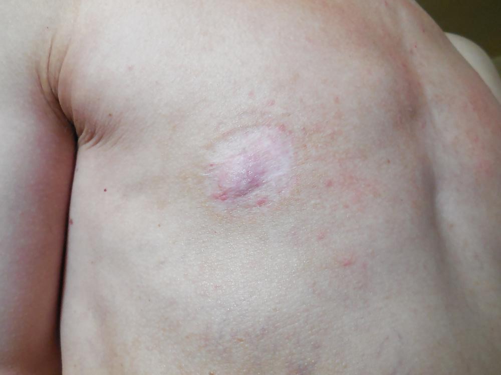 25P Tits in pain