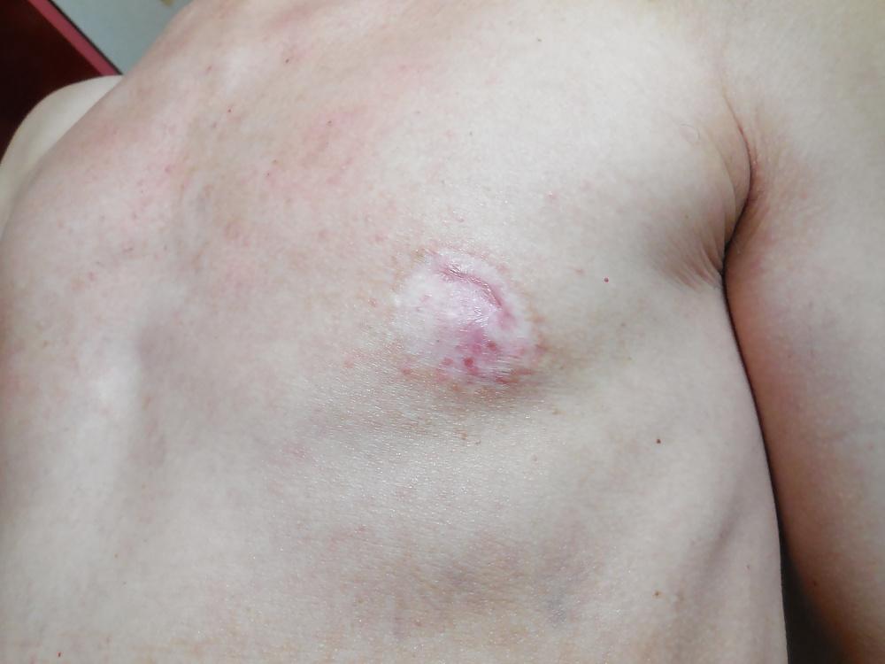 25P Tits in pain