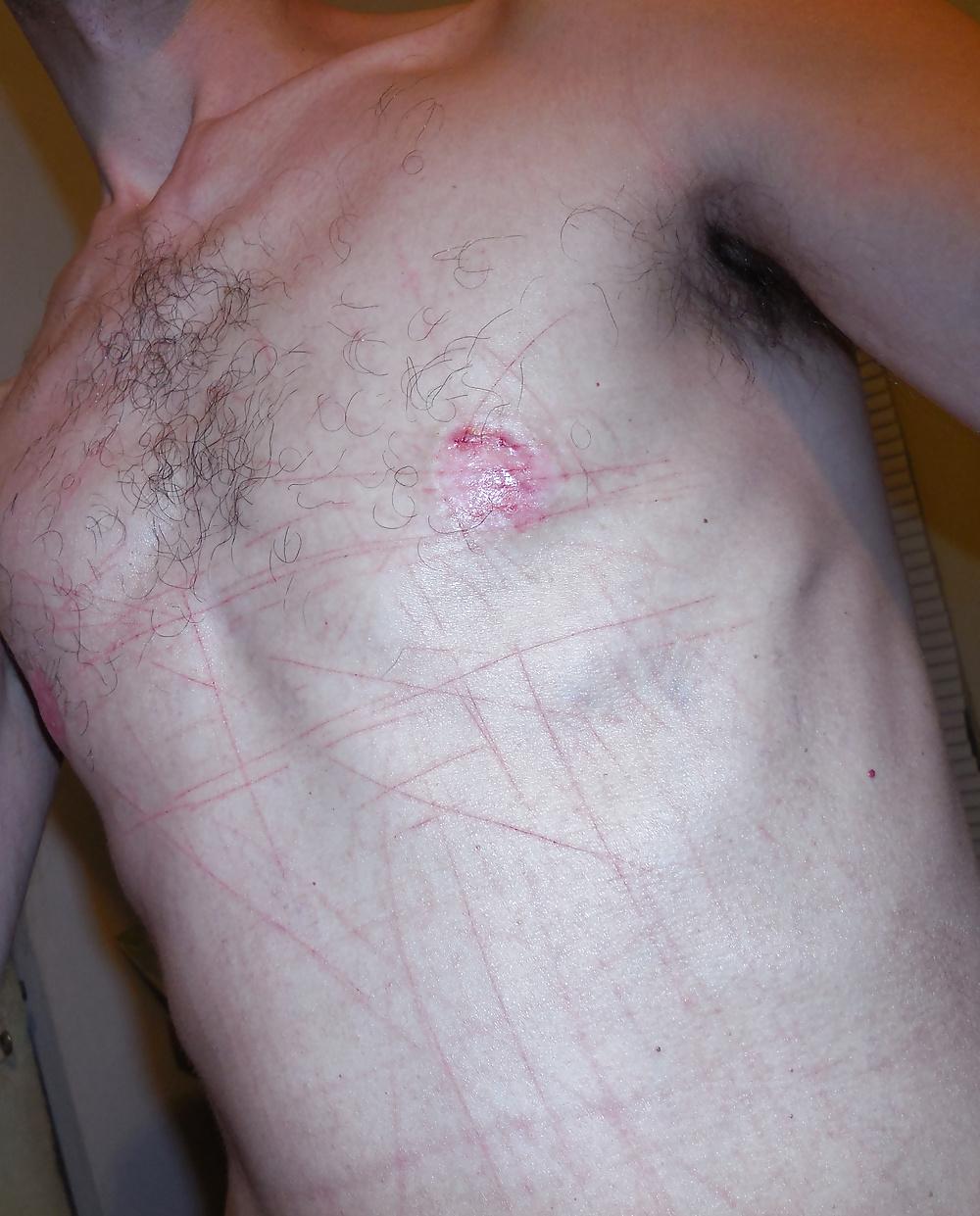 25P Tits in pain