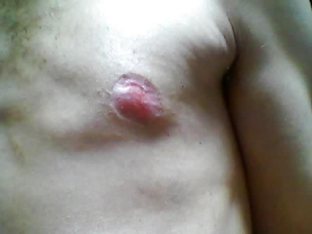 25P Tits in pain
