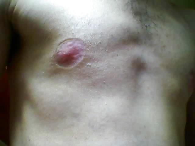 25P Tits in pain