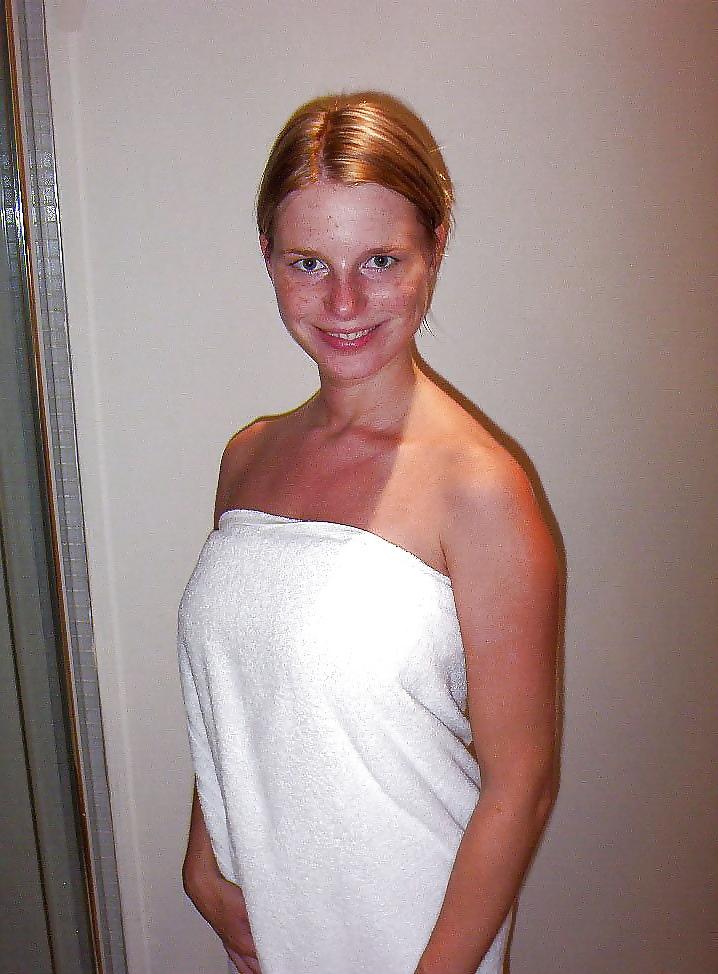 25P Freckles Love Them 5