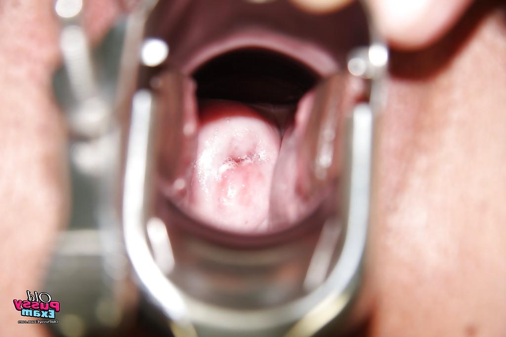 16P Naughty mature nurse stuffing her twat with a big dildo and gyno stuff