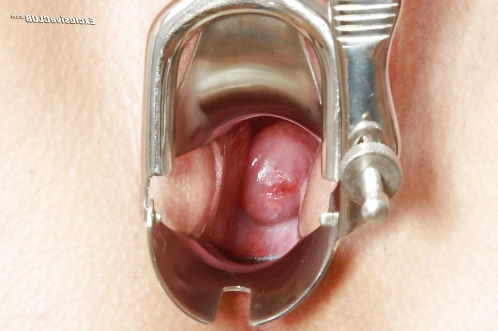 16P Gentle babe Nicoleta Emilie has extremely big fun with medical toys
