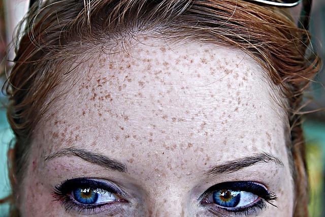 22P Freckles: a constellation 