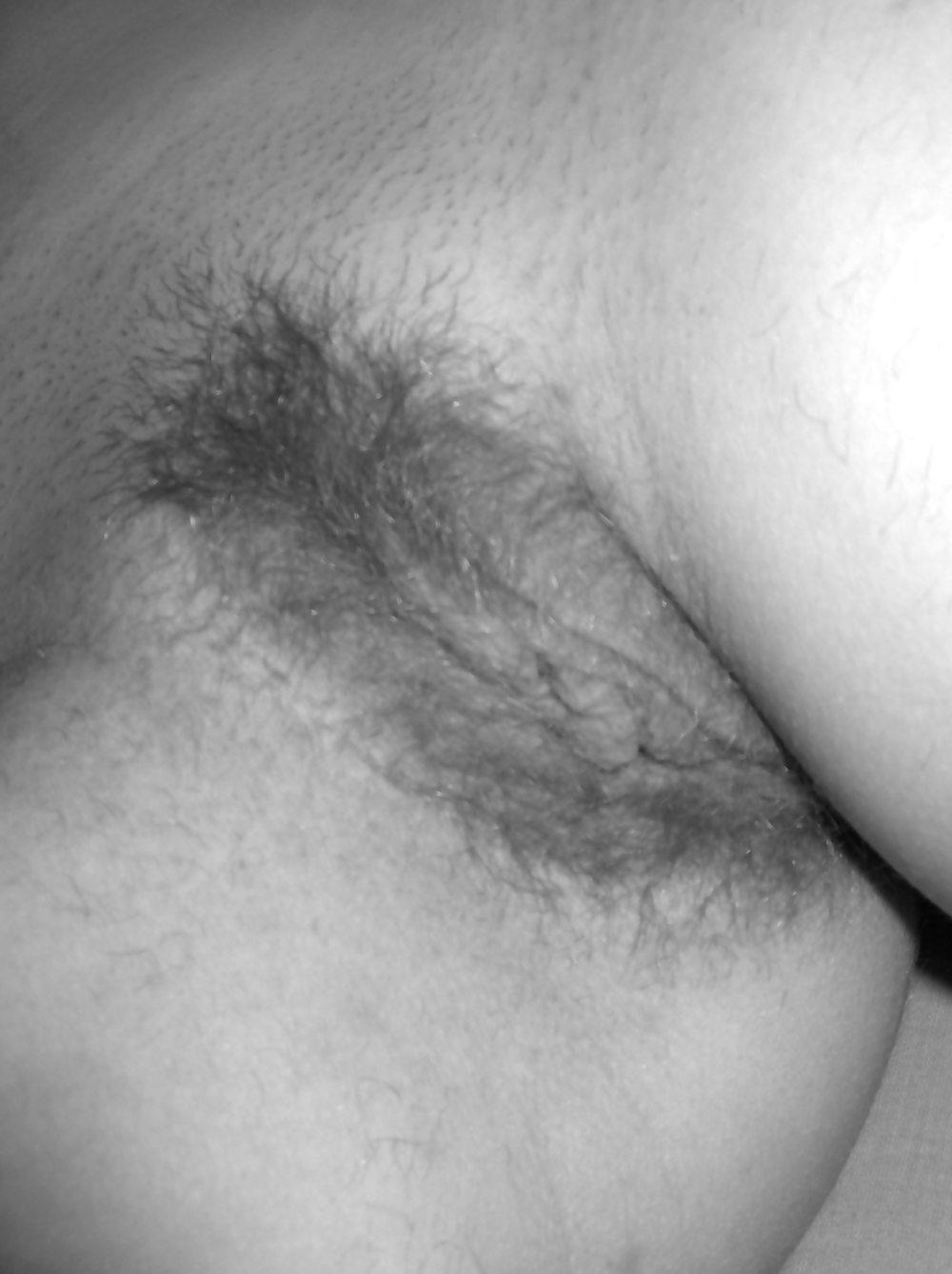 17P French hairy