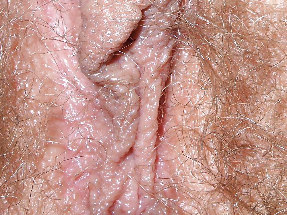 17P French hairy
