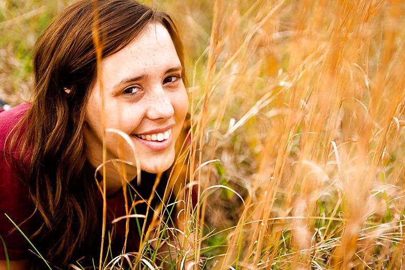 7P Freckles In A Field