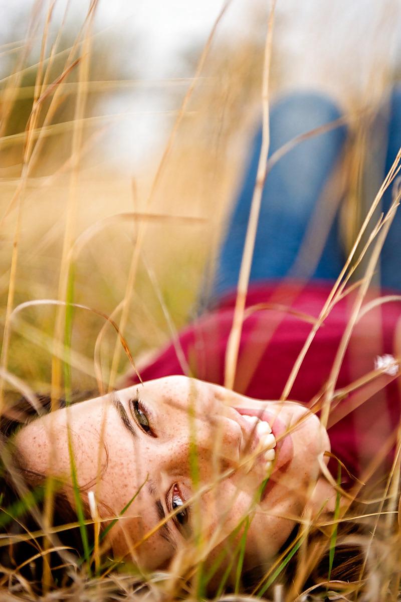 7P Freckles In A Field