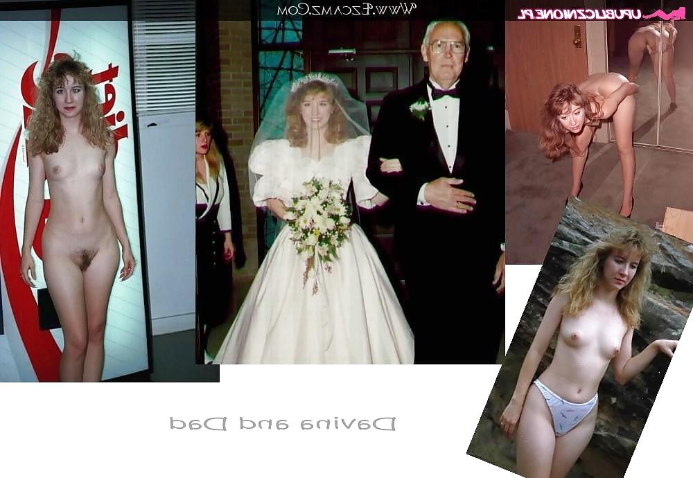 25P Dress Undress: Wedding