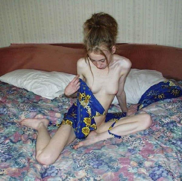 11P Skinny Girls