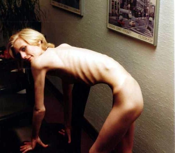 11P Skinny Girls