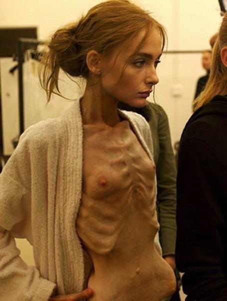 11P Skinny Girls