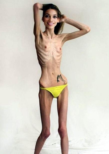 11P Skinny Girls