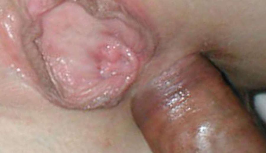 15P Picture gallery of bitches getting their buttholes drilled