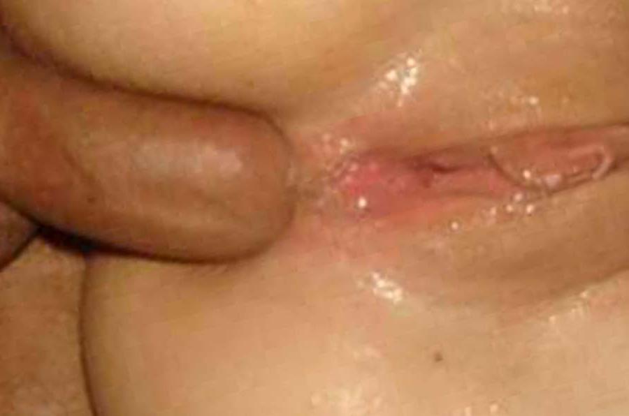 15P Picture gallery of bitches getting their buttholes drilled