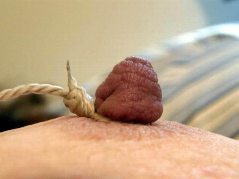 15P Huge erected nipples pierced and bondaged
