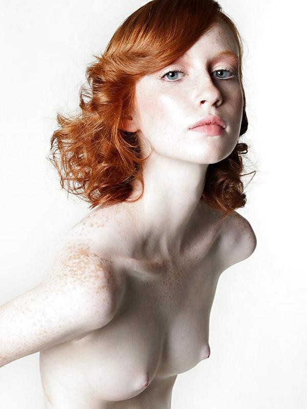 25P Freckles 3