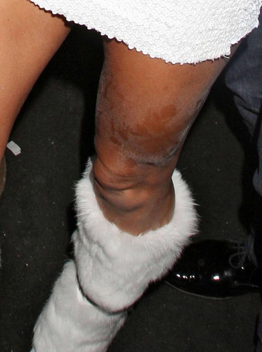 16P Katie Price showing her huge tits and sexy ass while she is drunk