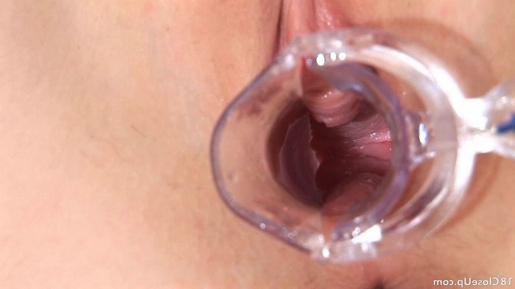 18P Closeups of busty teen pussy spreads with speculum