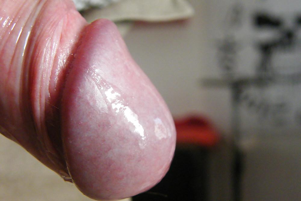 5P Lollipop