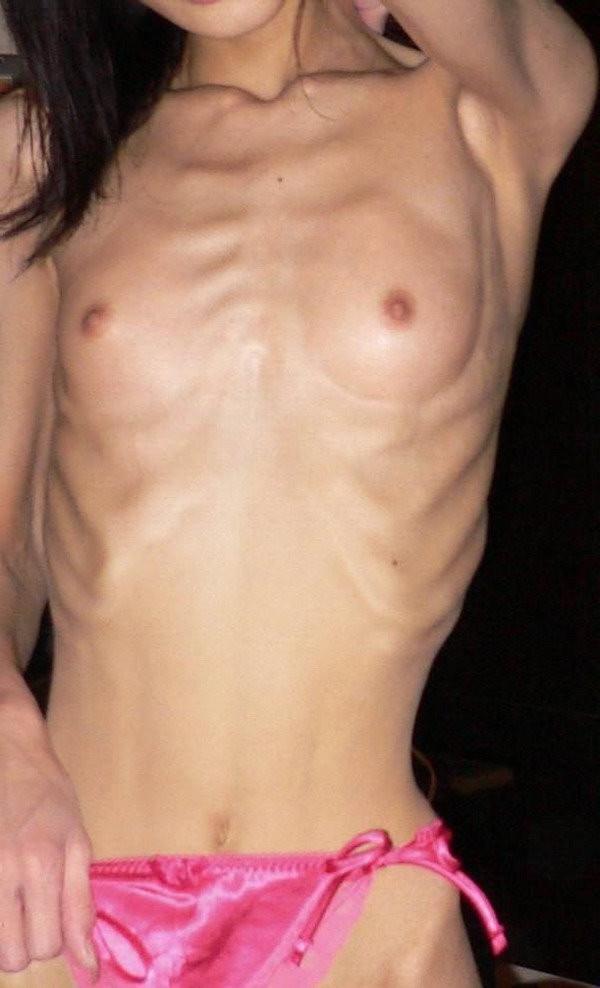 20P Skinny Girls