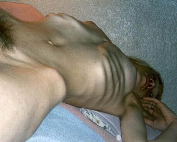 14P Skinny Girls