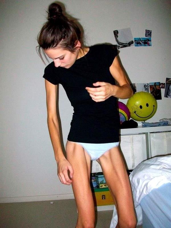20P Skinny Girls