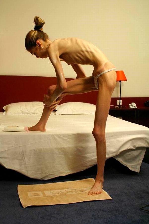 20P Skinny Girls
