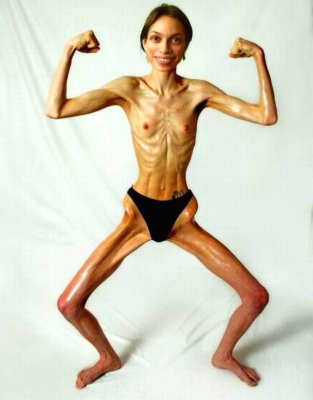 20P Skinny Girls