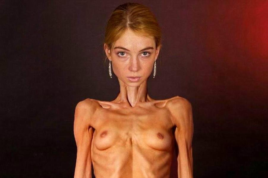 20P Skinny Girls