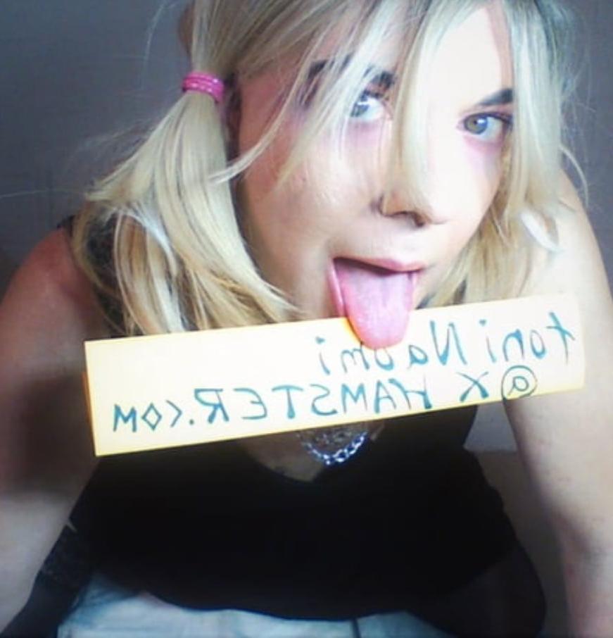13P Exposed