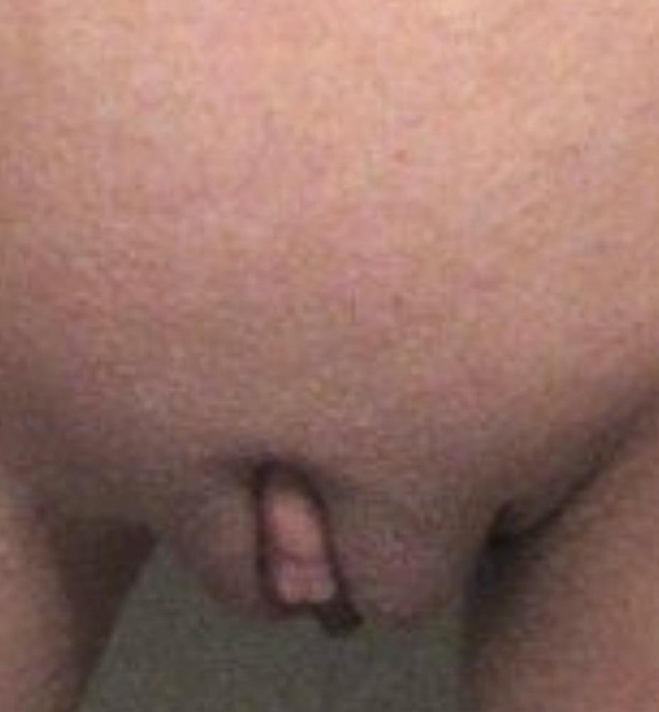 18P Tall And Sexy Brunette Teen With Freckles And Great Tits