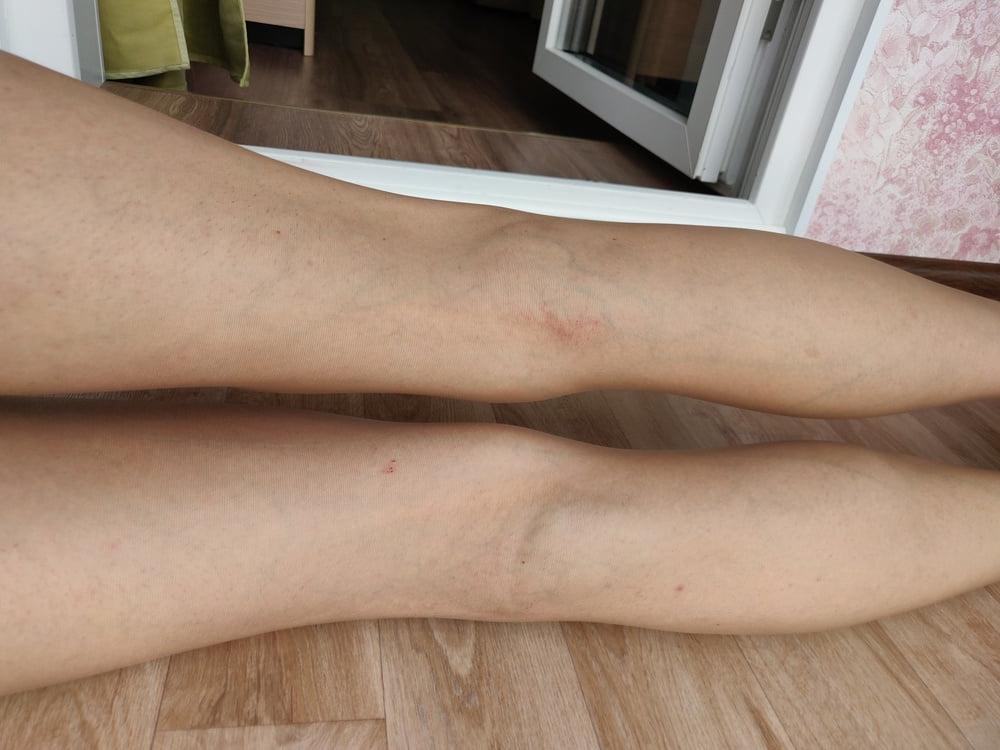 25P anal ass pantyhose stockings