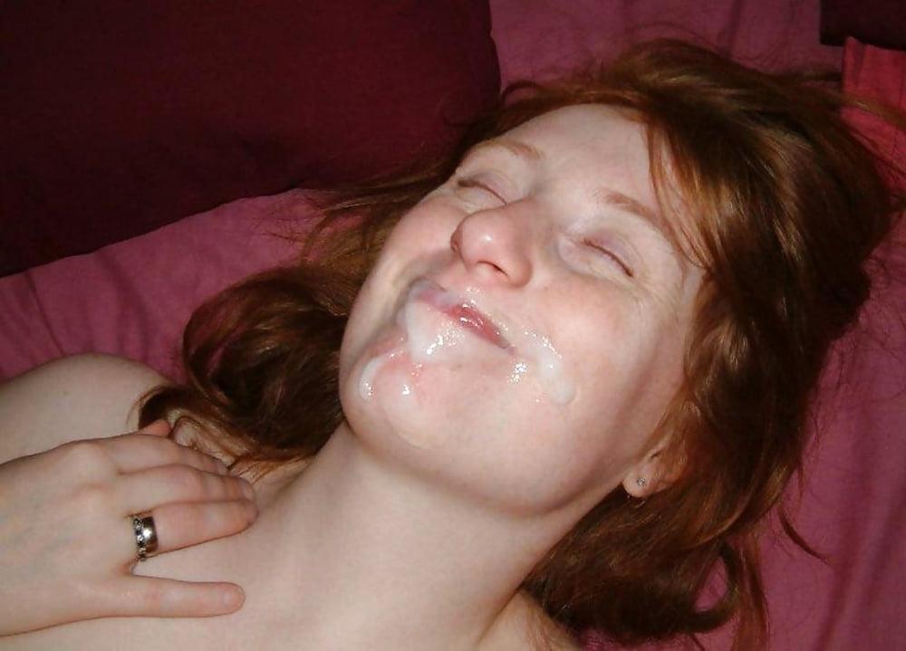 25P fair skin and freckles