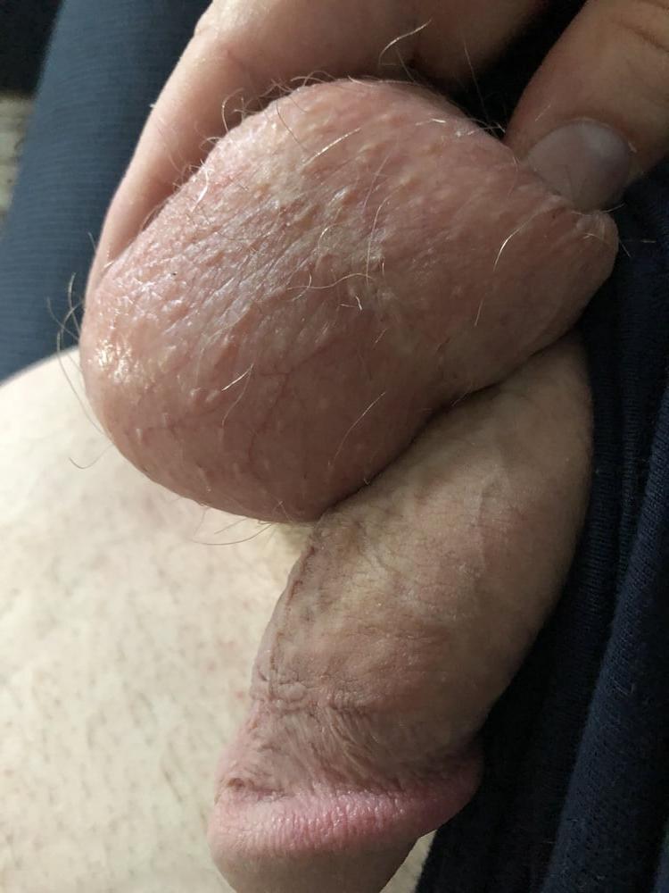 9P My dick