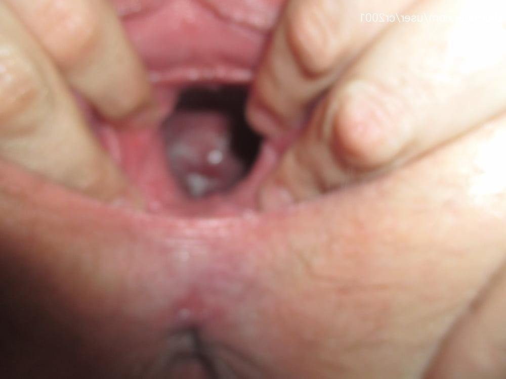 25P Tina, BBW Exteme Whore