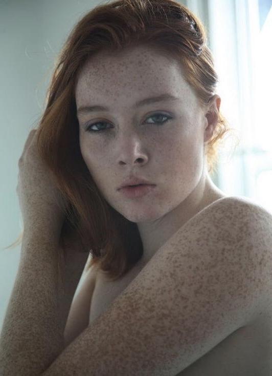 25P Beautiful freckled girl