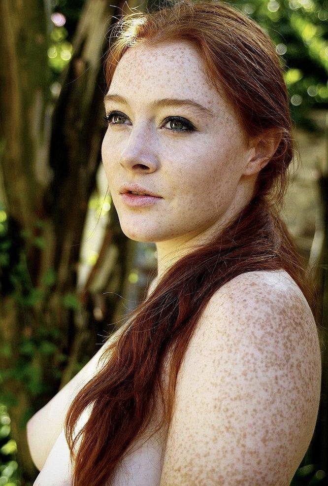 25P Beautiful freckled girl