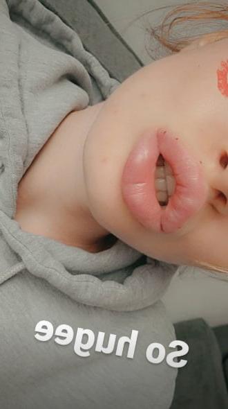 5P lips done finaly 3.1mil in em