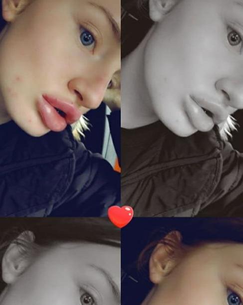5P lips done finaly 3.1mil in em