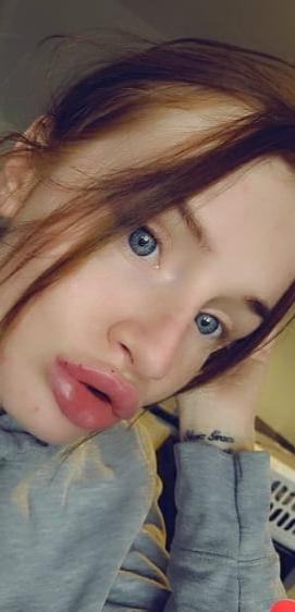 5P lips done finaly 3.1mil in em