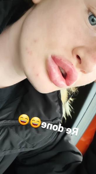 5P lips done finaly 3.1mil in em