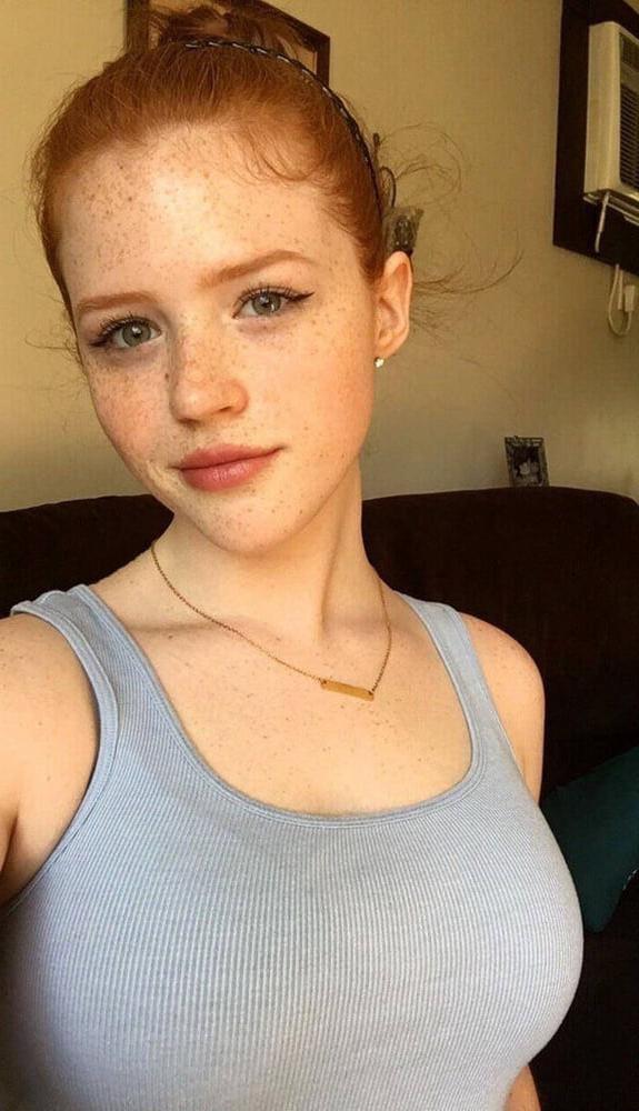 12P Freckled faces