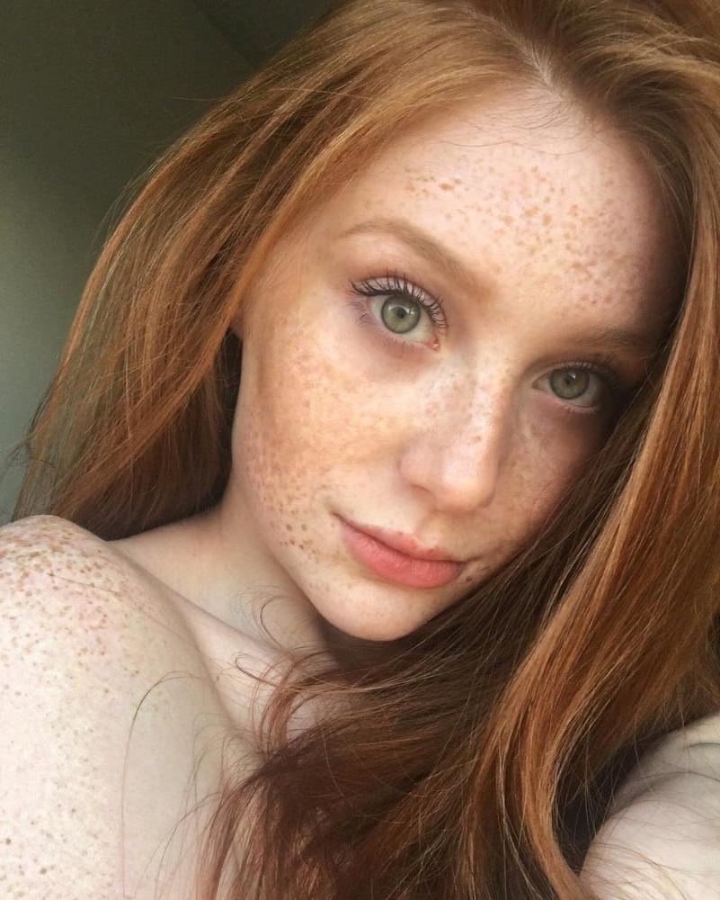 12P Freckled faces