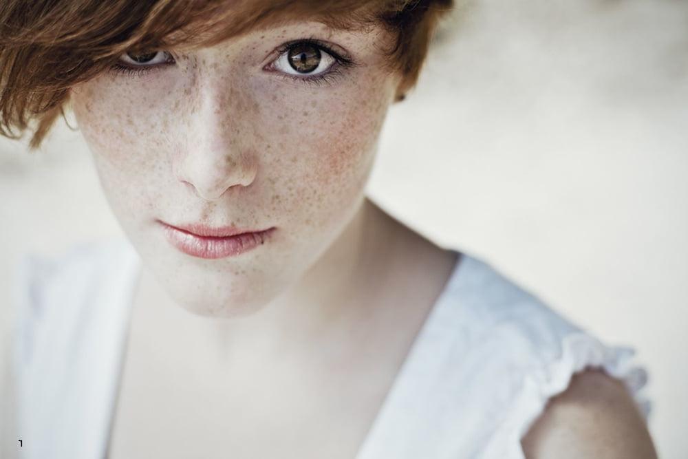 12P Freckled faces