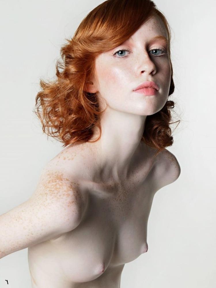 12P Freckled faces