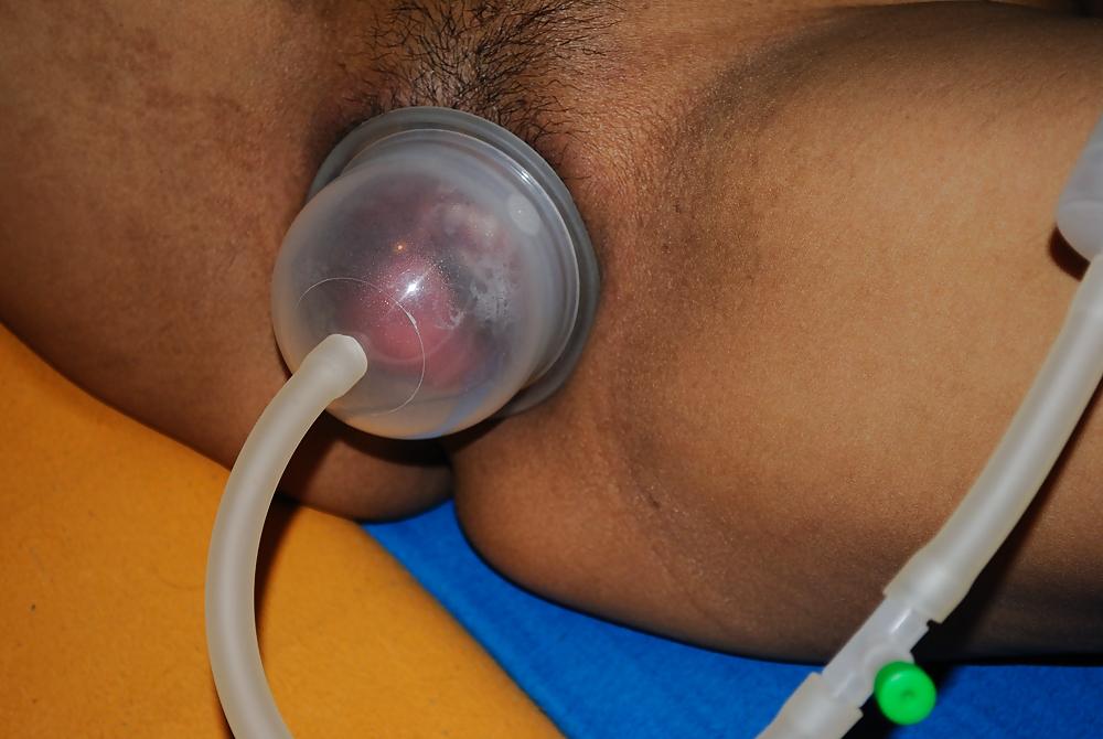 25P Thai pump Fotze dick